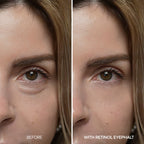 [Day&Night Care] Eyephalt Eyebag Lifting Line